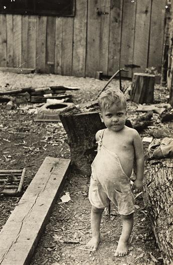 ARTHUR ROTHSTEIN (1915-1985) Son of a Sharecropper, Mississippi County, Arkansas * Sharecroppers child suffering from rickets and maln